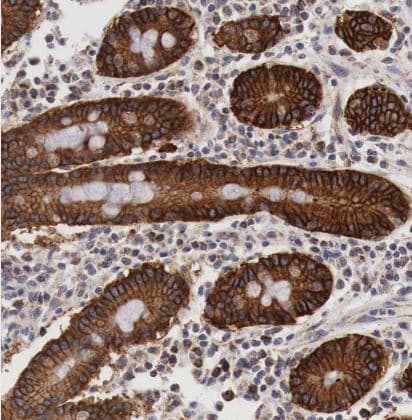 XPNPEP3 Antibody