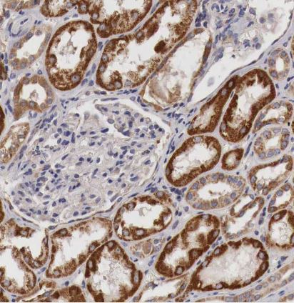 XPNPEP3 Antibody