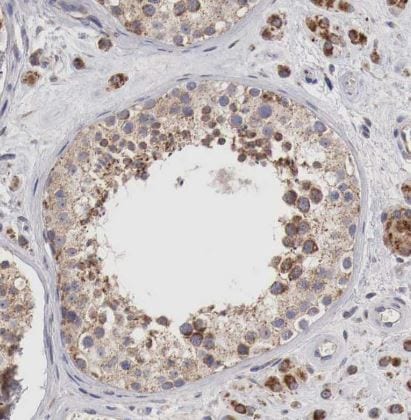 XPNPEP3 Antibody