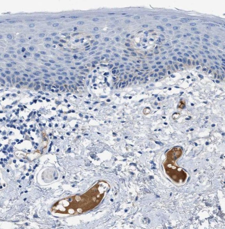 Apolipoprotein L1 Antibody - BSA Free