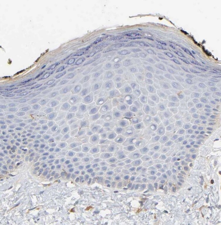 BIN1 Antibody - BSA Free