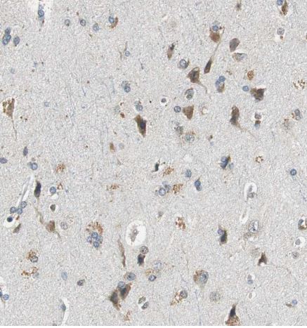 ALDH4A1 Antibody