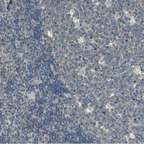 ALDH4A1 Antibody