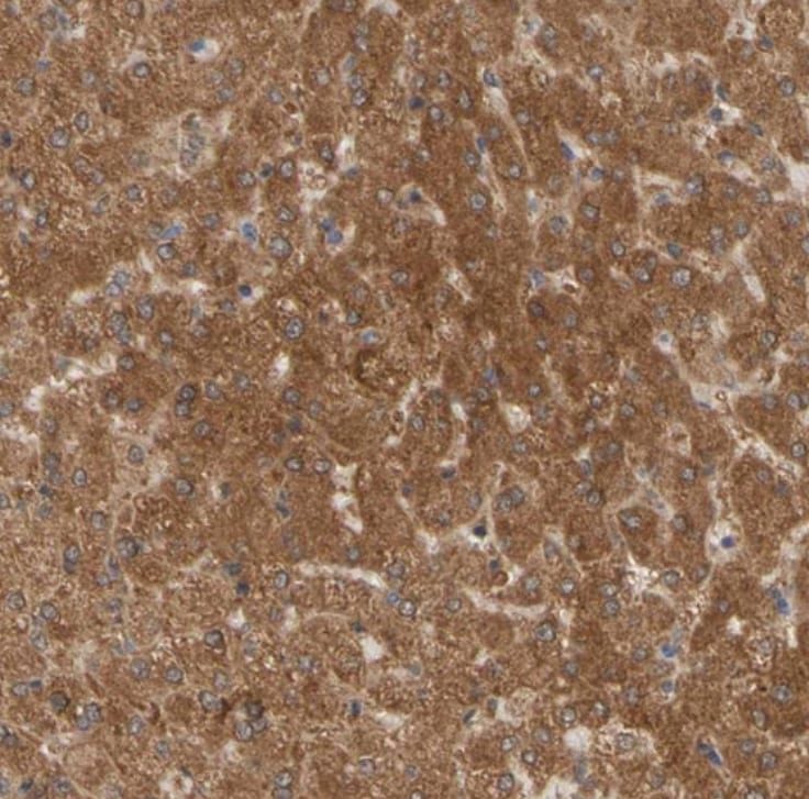 ALDH9A1 Antibody - BSA Free