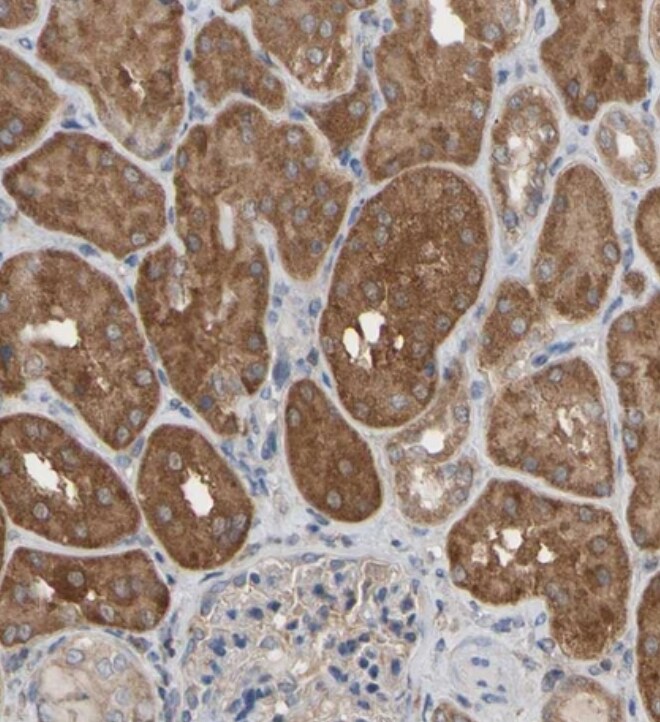 ALDH9A1 Antibody - BSA Free