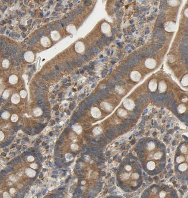 ALDH9A1 Antibody - BSA Free