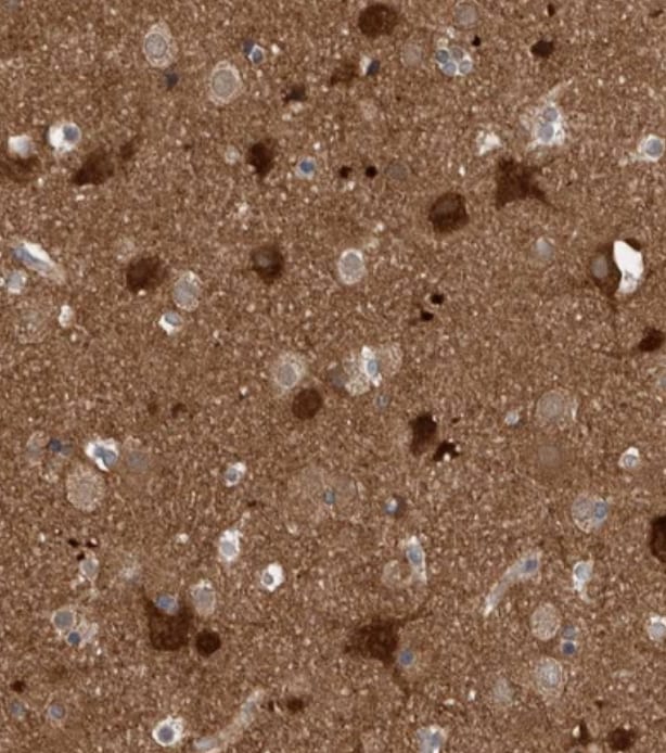 GBA2 Antibody - BSA Free
