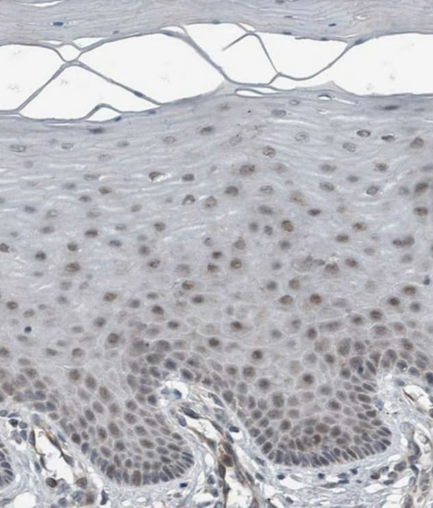 GBA2 Antibody - BSA Free