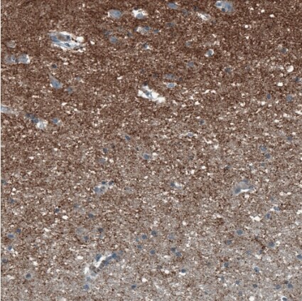 SCD5 Antibody - BSA Free