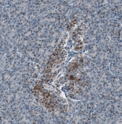 SCD5 Antibody - BSA Free