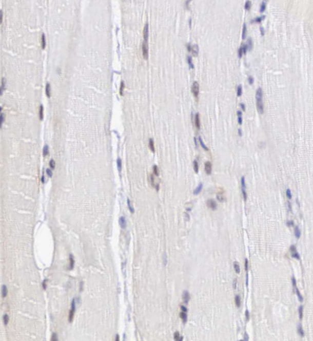 MORC2 Antibody - BSA Free