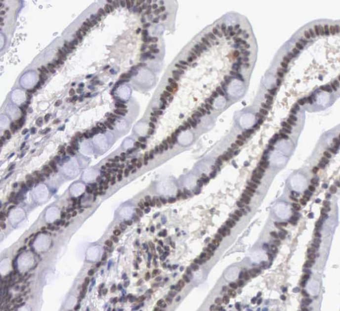 MORC2 Antibody - BSA Free