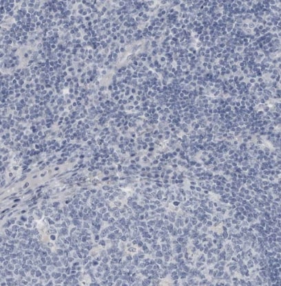 ABHD12 Antibody - BSA Free