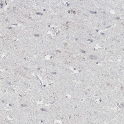 ABHD12 Antibody - BSA Free