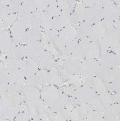 ABHD12 Antibody - BSA Free