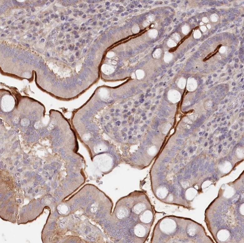 TCHP Antibody