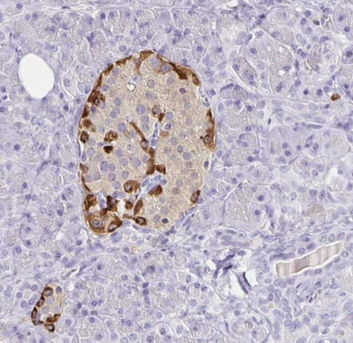 Transthyretin/Prealbumin Antibody - BSA Free