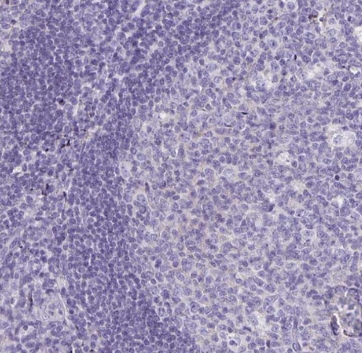 Transthyretin/Prealbumin Antibody - BSA Free