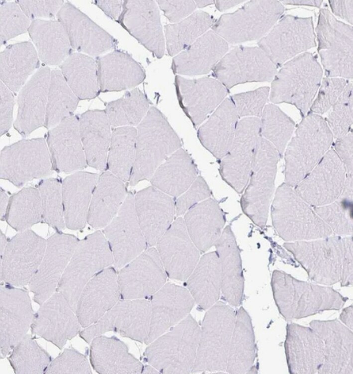 Transthyretin/Prealbumin Antibody - BSA Free