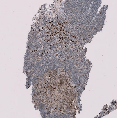 RMI2 Antibody - BSA Free