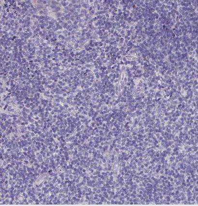 CFAP74 Antibody