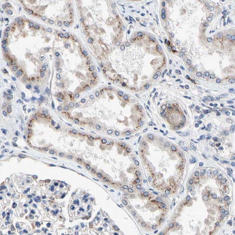 TMED7 Antibody