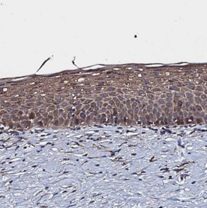 RAB12 Antibody - BSA Free