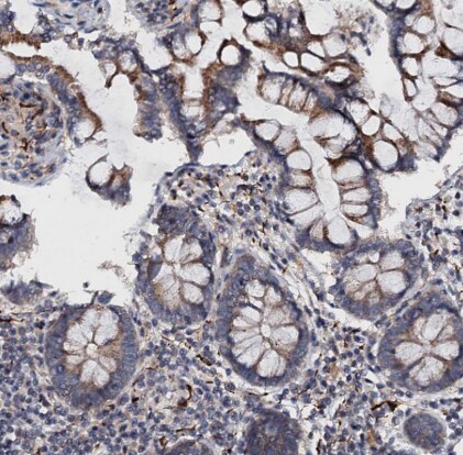 FAM155A Antibody
