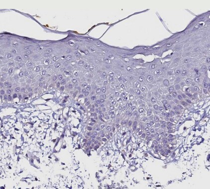 FAM155A Antibody