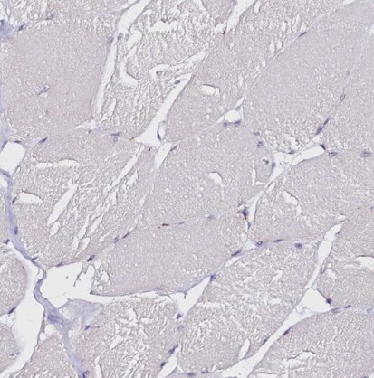 FAM155A Antibody