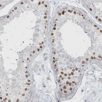 PRDM6 Antibody