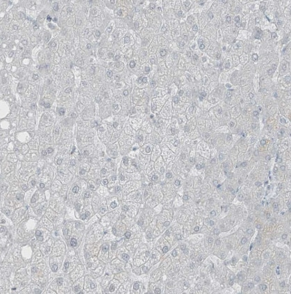 PRDM6 Antibody