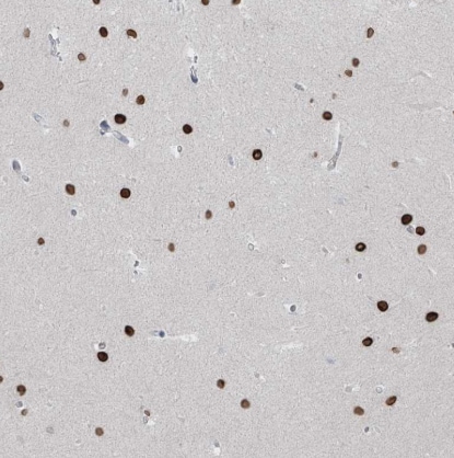 PRDM6 Antibody