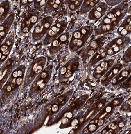 LIPT2 Antibody