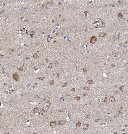 LIPT2 Antibody