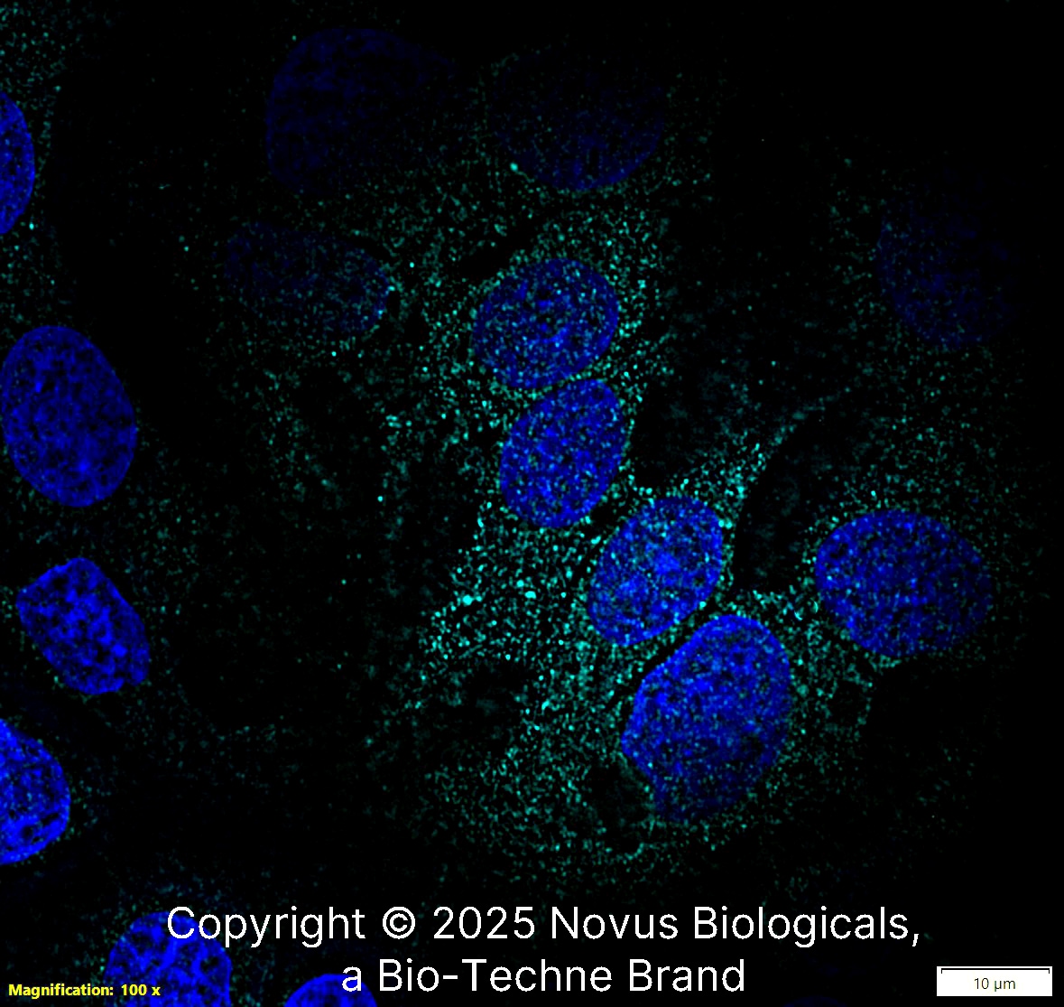 Fibronectin Antibody - BSA Free