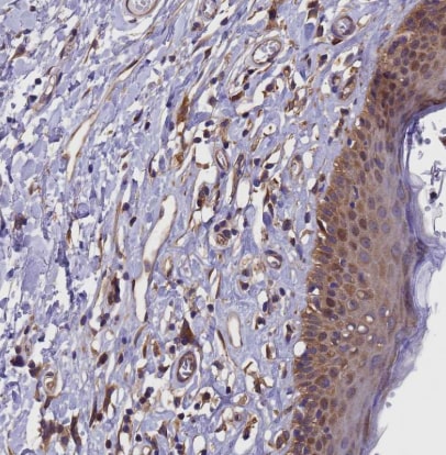 GID4 Antibody
