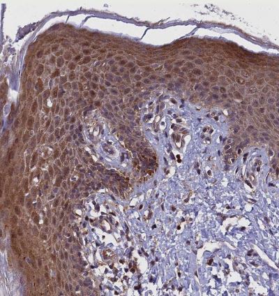 COMMD2 Antibody