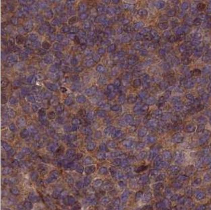 COMMD2 Antibody