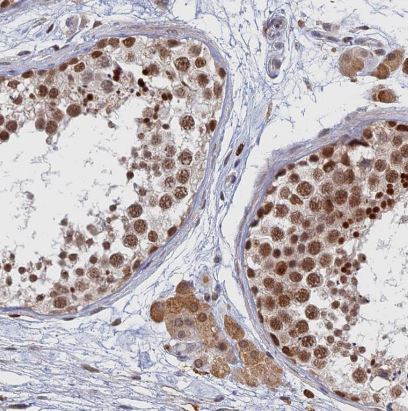 GPATCH1 Antibody