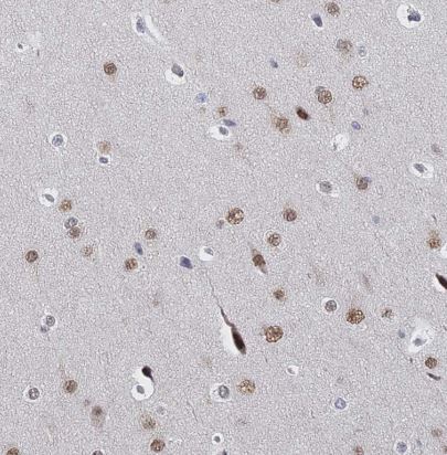 GPATCH1 Antibody