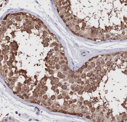 INPP4A Antibody