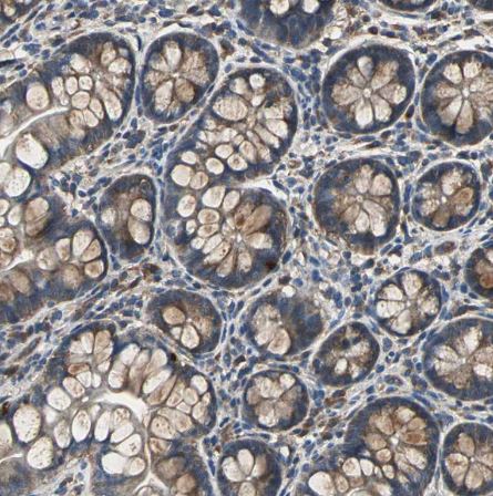 IRF3 Antibody