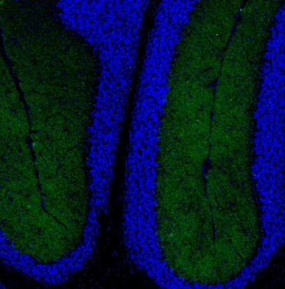 Neurokinin B Antibody