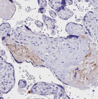 Neurokinin B Antibody