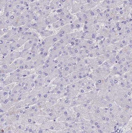 Neurokinin B Antibody