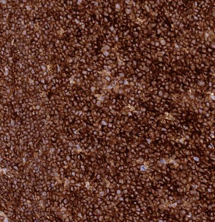 Immunohistochemistry-Paraffin: TTPAL Antibody [NBP1-92544]
