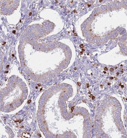 TTPAL- Antibody- NBP1-92544