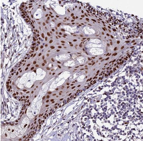ZNF707 Antibody