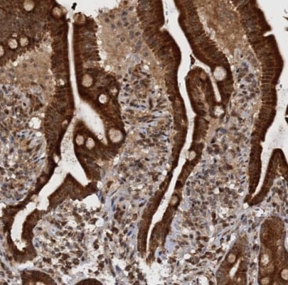 REP15 Antibody - BSA Free